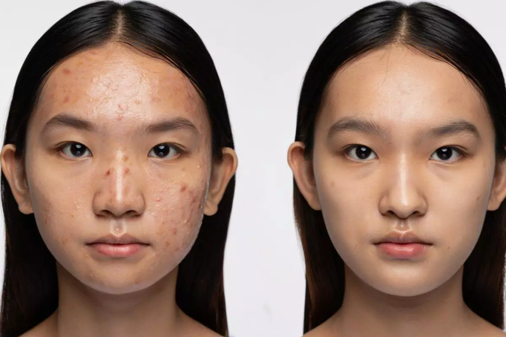 Kulit Glowing Ala Korea dalam 7 Hari 2026